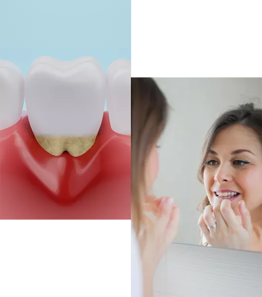 perio